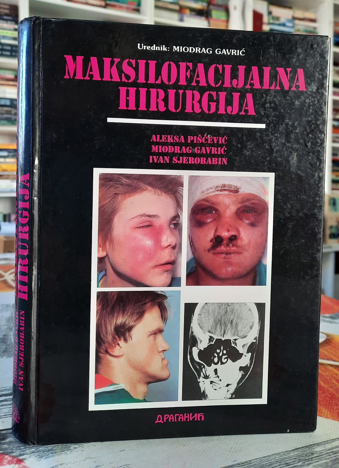 Maksilofacijalna hirurgija - Miodrag Gavrić